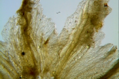 Cuscuta alata, calyx dissected (lobes detail)