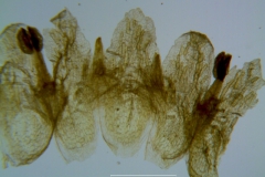 Cuscuta applanata, corolla dissected