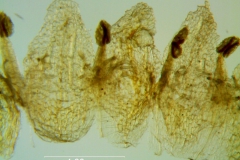 Cuscuta azteca, corolla dissected