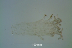 Cuscuta azteca, infrastaminal scale