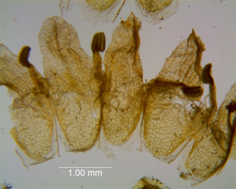 Cuscuta carinata, corolla, dissected