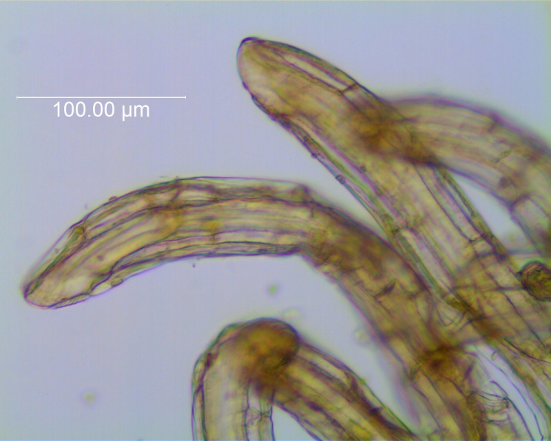 Cuscuta carinata, infrastaminal scales fimbriae detail