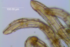 Cuscuta carinata, infrastaminal scales fimbriae detail