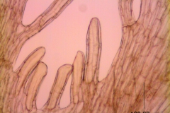 Cuscuta campestris, scale fimbriae with laticifers (taken by Kristy Dockstader)