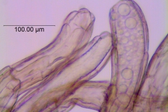 Cuscuta campestris, scale fimbriae with laticifers (taken by Kristy Dockstader)