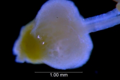 Cuscuta campestris, ovary (taken by Kristy Dockstader)