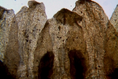 Cuscuta foetida var. pycnantha; corolla lobes detail