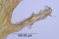 Cuscuta foetida var. pycnantha; scale fimbriae
