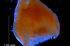 Cuscuta foetida var. pycnantha; ovary