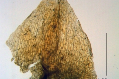 Cuscuta foetida var. pycnantha; bract detail