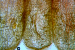Cuscuta rubella, corolla and scales