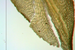 Cuscuta serrata, bract detail