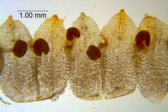 Cuscuta warneri, corolla dissected
