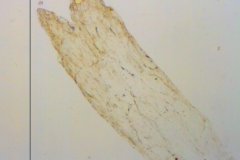 Cuscuta warneri, scale