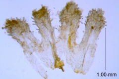 Cuscuta xanthochortos var. lanceolata, scales