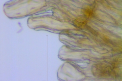 Cuscuta xanthochortos var. lanceolata, scale fimbriae