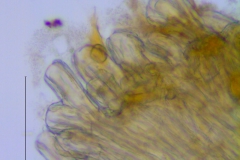 Cuscuta xanthochortos var. lanceolata, scale fimbriae