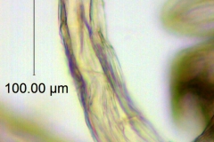 Cuscuta werdermannii, fimbriae