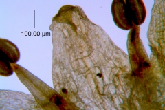 Cuscuta pauciflora, corolla lobe detail