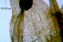 Cuscuta pauciflora, corolla lobe detail