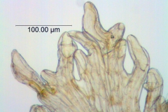 Cuscuta pauciflora, scale fimbriae with latex