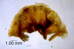 Cuscuta rugosiceps, calyx dissected