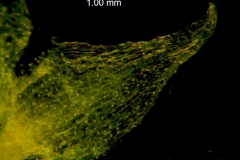 Cuscuta pacifica var. papillata; dissected calyx: corolla lobe detail