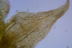 Cuscuta pacifica var. papillata; dissected calyx: corolla lobe detail