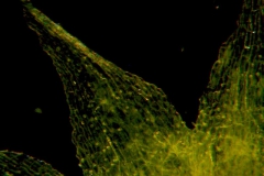 Cuscuta pacifica var. papillata; dissected calyx: corolla lobe detail