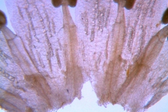 Cuscuta pacifica var. papillata;  dissected corolla: infrastaminal scales
