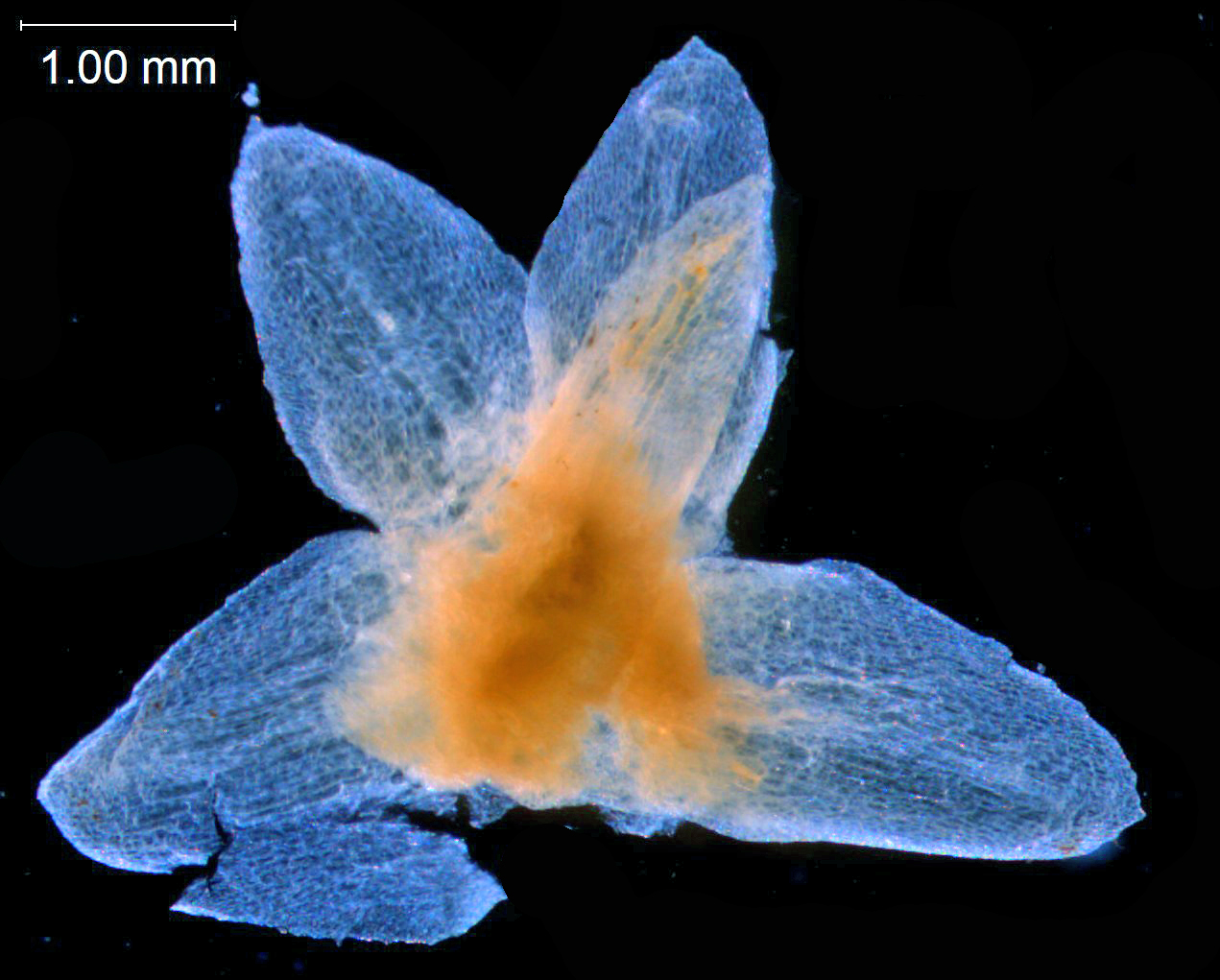 Calyx, dissected (bract also visible)