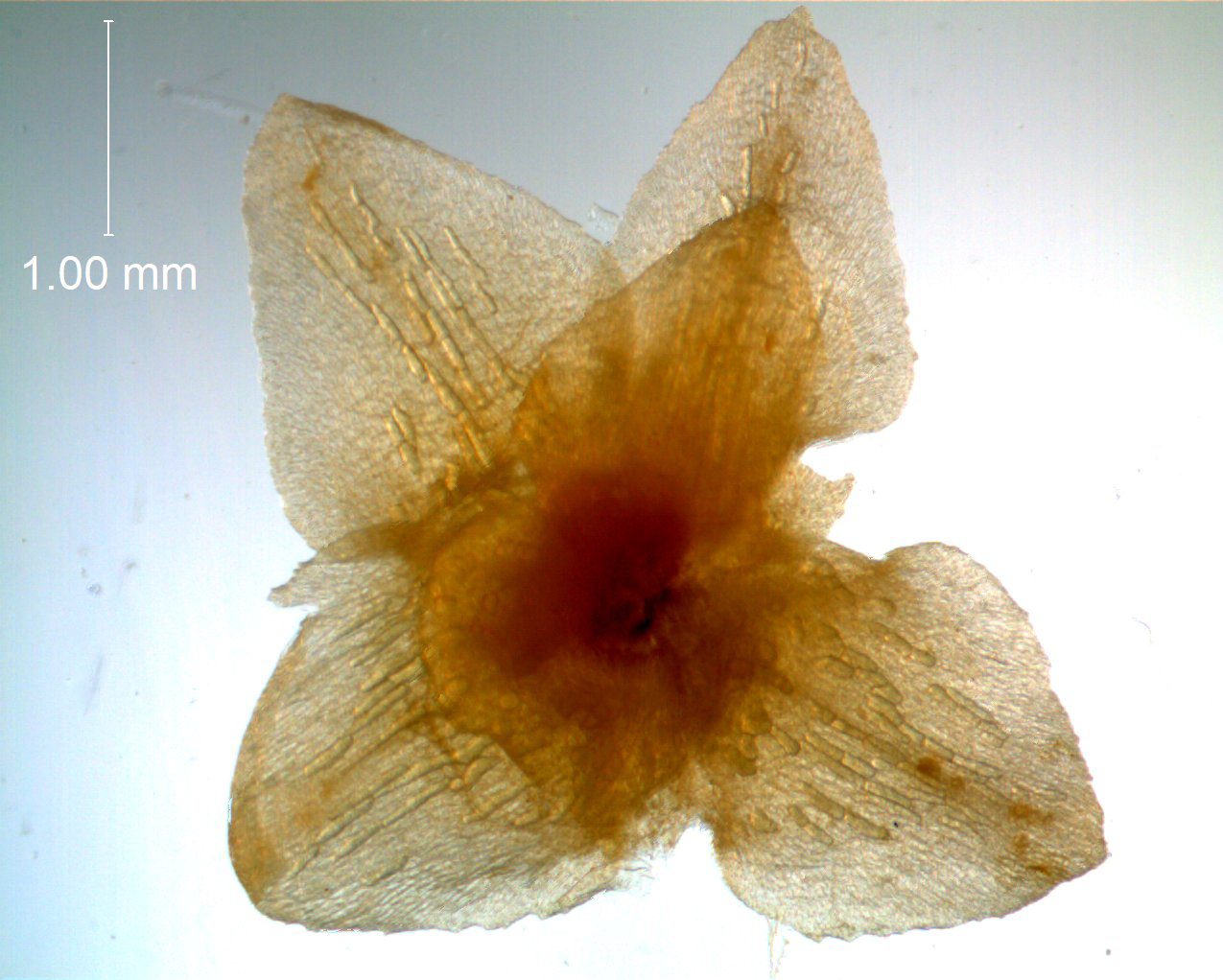 Calyx, dissected (bract also visible)