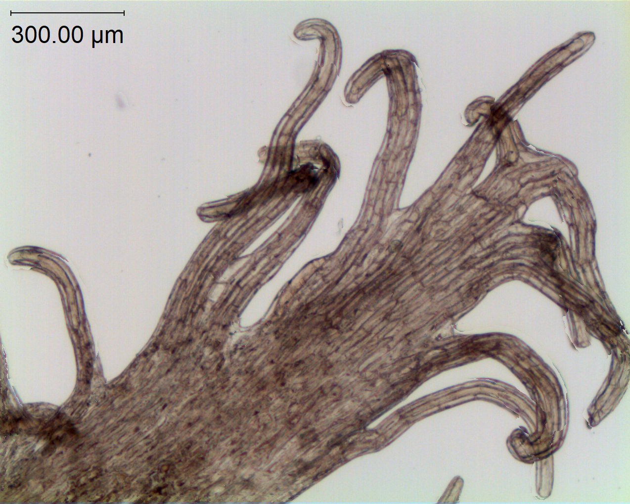 Infrastaminal scale fimbriae