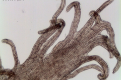 Infrastaminal scale fimbriae