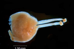 Gynoecium